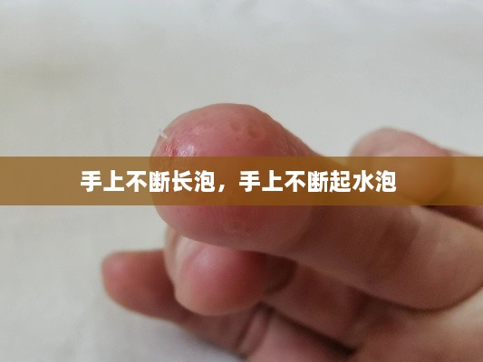 手上不断长泡，手上不断起水泡 